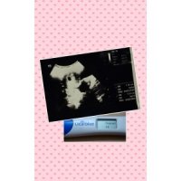 Clearblue Digital Pregnancy Test 